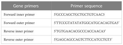 Tetra-ARMS PCR analysis of angiotensinogen AGT T174M (rs4762) genetic polymorphism in diabetic patients: a comprehensive study